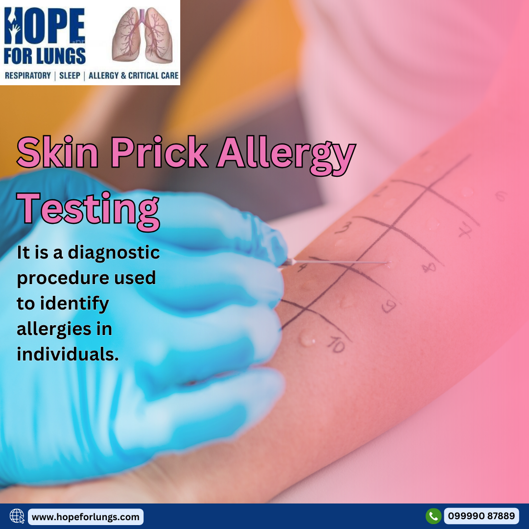 Skin prick allergy